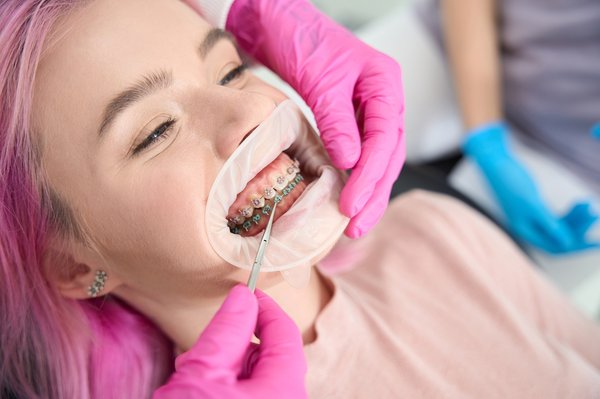 L'orthodontiste à vauréal : un sourire sur mesure pour vous